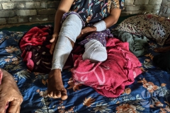 'Living is resistance': The young mother maimed at her own doorstep