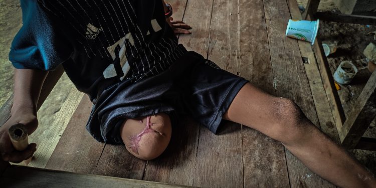 Driven Underground: The Myanmar Children Dodging Airstrikes to Learn