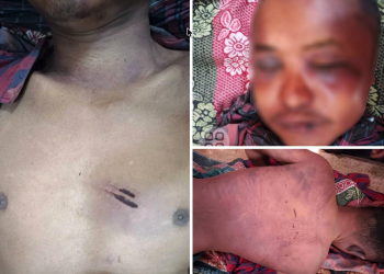 UG Battalion Accused of Torturing and Killing Civilian in Magway Region