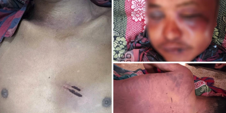 UG Battalion Accused of Torturing and Killing Civilian in Magway Region
