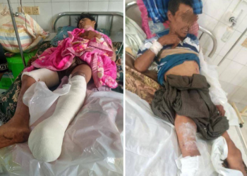 Landmines and War Scraps Claim 35 Casualties in Northern Shan State