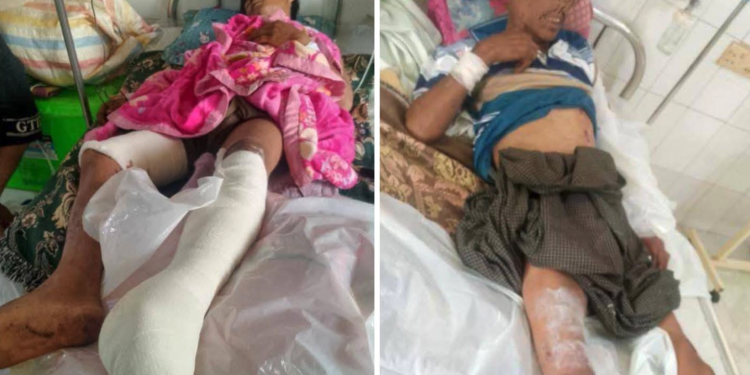 Landmines and War Scraps Claim 35 Casualties in Northern Shan State